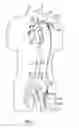 Fig. 04 - Cannulae having a redirecting tip
