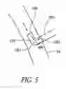 Fig. 06 - Cannulae having a redirecting tip