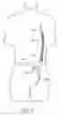 Fig. 10 - Cannulae having a redirecting tip