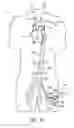 Fig. 11 - Cannulae having a redirecting tip