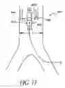 Fig. 16 - Cannulae having a redirecting tip