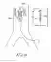 Fig. 17 - Cannulae having a redirecting tip