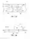 Fig. 19 - Cannulae having a redirecting tip