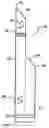 Fig. 01 - Multilumen catheter for minimizing limb ischemia
