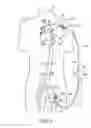 Fig. 07 - Cannulae having a redirecting tip