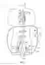 Fig. 08 - Cannulae having a redirecting tip