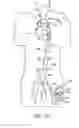 Fig. 11 - Cannulae having a redirecting tip