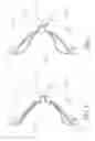 Fig. 04 - Air bag nursing bra