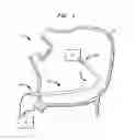 Fig. 02 - Steerable catheter