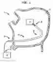 Fig. 02 - Steerable catheter