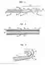 Fig. 03 - Steerable catheter