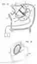Fig. 07 - Steerable catheter