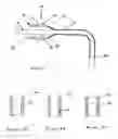 Fig. 02 - Expandable esophageal access device