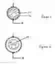 Fig. 03 - Expandable esophageal access device