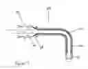 Fig. 06 - Expandable esophageal access device