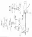 Fig. 05 - Safety spring catheter introducer assembly