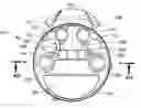 Fig. 01 - Implantable infusion device with multiple controllable fluid outlets