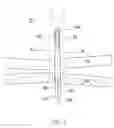 Fig. 02 - Gastric fastening system