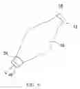 Fig. 06 - Gastric fastening system