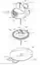 Fig. 01 - Infusion set