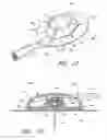 Fig. 11 - Infusion set