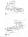 Fig. 06 - Anchoring system for use with neonates