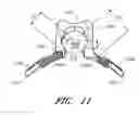 Fig. 08 - Anchoring system for use with neonates