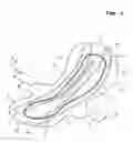 Fig. 02 - Sanitary napkin