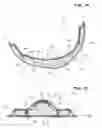 Fig. 19 - Sanitary napkin