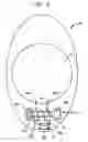 Fig. 05 - Multi-reservoir implantable pump with variable flow rate capabilities