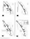 Fig. 12 - Methods for treating eye conditions