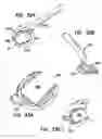 Fig. 22 - Methods for treating eye conditions