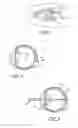 Fig. 02 - Method and apparatus for aligning a mask with the visual axis of an eye