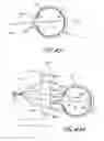 Fig. 09 - Method and apparatus for aligning a mask with the visual axis of an eye