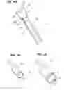 Fig. 04 - Ablation instruments and methods for performing abalation