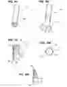 Fig. 08 - Ablation instruments and methods for performing abalation