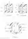 Fig. 03 - Assisted systems and methods for performing transvaginal hysterectomies