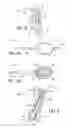 Fig. 07 - Methods and electrode apparatus to achieve a closure of a layered tissue defect