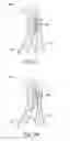 Fig. 08 - Methods and electrode apparatus to achieve a closure of a layered tissue defect