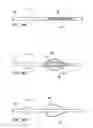 Fig. 09 - Methods and electrode apparatus to achieve a closure of a layered tissue defect