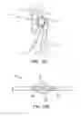 Fig. 10 - Methods and electrode apparatus to achieve a closure of a layered tissue defect