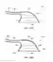 Fig. 24 - Methods and electrode apparatus to achieve a closure of a layered tissue defect