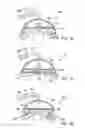 Fig. 29 - Methods and electrode apparatus to achieve a closure of a layered tissue defect