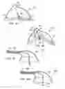 Fig. 32 - Methods and electrode apparatus to achieve a closure of a layered tissue defect