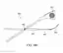 Fig. 35 - Methods and electrode apparatus to achieve a closure of a layered tissue defect
