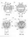 Fig. 41 - Methods and electrode apparatus to achieve a closure of a layered tissue defect