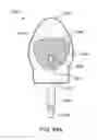 Fig. 42 - Methods and electrode apparatus to achieve a closure of a layered tissue defect