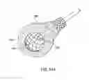 Fig. 44 - Methods and electrode apparatus to achieve a closure of a layered tissue defect