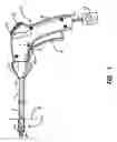 Fig. 02 - Cutting and coagulating electrosurgical forceps having cam controlled jaw closure