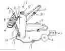 Fig. 01 - User-attached, manually operated fluid-driven arm lift device